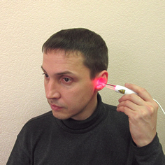 Воздействие на наружный слуховой проход с помощью рассеивающей насадки к К-лазерному модулю при лечении отитов